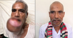 ২০ বছরের কষ্ট ১২ ঘণ্টায় লাঘব, রমেক চিকিৎসকদের অবিস্মরণীয় সাফল্য