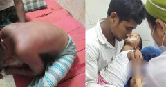 ভিমরুলের কামড়: চিকিৎসাধীন বাবা ও দুই সন্তানের মৃত্যু