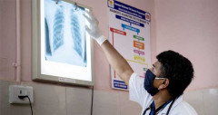 যক্ষ্মা মহামারী রূপ নেওয়ার শঙ্কা বিশ্ব স্বাস্থ্য সংস্থার