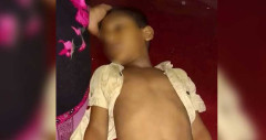 অ্যান্টিভেনমের অভাবে কুষ্টিয়া সদর হাসপাতালে প্রাণ গেল শিশুর