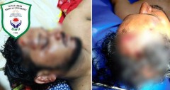 শরীয়তপুরে ডা. নাসিরের ওপর হামলার ঘটনায় দোষীদের দৃষ্টান্তমূলক শাস্তির দাবি বিএমইউর