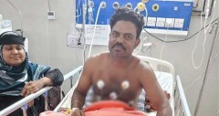 সাপের কামড়ে আক্রান্ত হয়ে হাসপাতালে ‘বিষঝাড়া ওঝা’, চিকিৎসা শেষে ফিরেছেন বাসায়