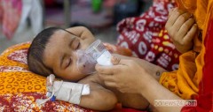 হাম উপসর্গে আরও ৩ শিশুর মৃত্যু, মোট ৯২৮