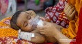 হাম উপসর্গে আরও ৩ শিশুর মৃত্যু, মোট ৯২৮