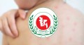হামের উপসর্গ নিয়ে আরও ৫ শিশুর মৃত্যু