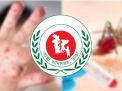 হাম উপসর্গ ও ডেঙ্গুতে একদিনে  ১৭ জনের মৃত্যু 