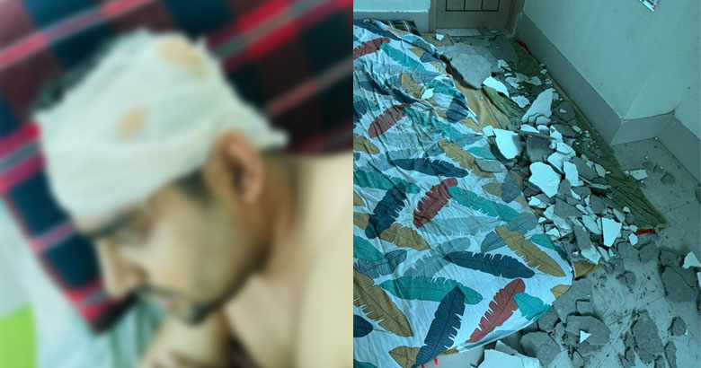 ছাদের পলেস্তারা ধসে চিকিৎসকের স্বামীর মাথায়, গুরুতর আহত