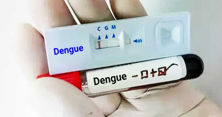 ডেঙ্গু কিট আমদানিতে লাগবে না কর