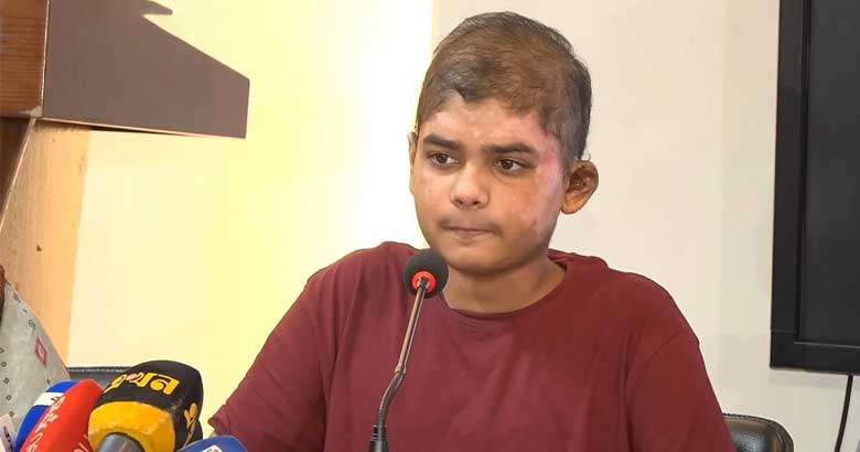 বিমান দুর্ঘটনায় দগ্ধ: ১২২ দিনের সংগ্রাম শেষে সুস্থ হয়ে বাড়ি ফিরল আরিয়ান