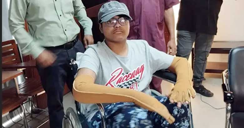 বিমান দুর্ঘটনায় দগ্ধ: ৯৭ দিনের লড়াই শেষে ঘরে ফিরলো নাভিদ