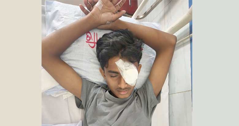 ছাত্রশক্তি নেতা আলিফের চোখে দৃষ্টিশক্তি ফেরার সম্ভাবনা নেই: চিকিৎসক