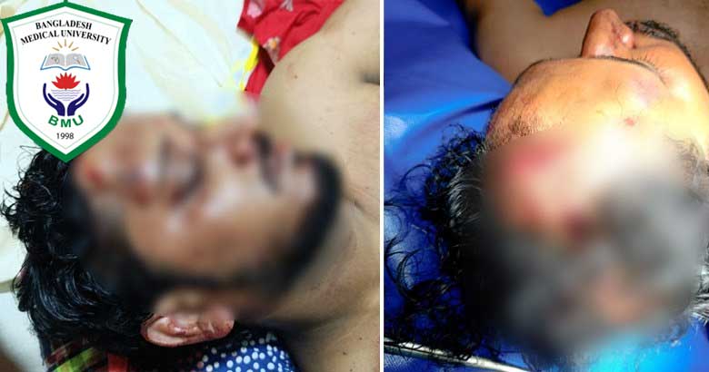 শরীয়তপুরে ডা. নাসিরের ওপর হামলার ঘটনায় দোষীদের দৃষ্টান্তমূলক শাস্তির দাবি বিএমইউর
